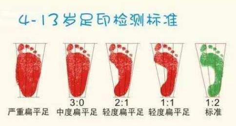 扁平足能跑步嗎？扁平足跑步有什么危害？
