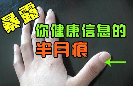 指甲上的半月痕你懂多少？指甲半月痕與健康吉兇關系